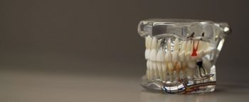 A model of a set of teeth