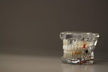 Dentist's model of a set of teeth