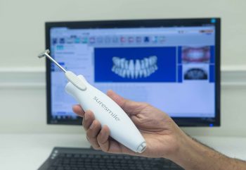 Suresmile scanner close up at The London Lingual Orthodontic Clinic