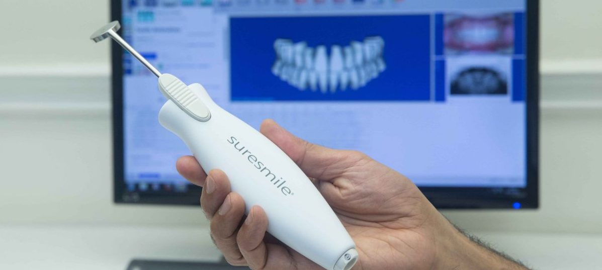 Suresmile scanner close-up copy Suresmile advanced digital dentistry techniques at The London Lingual Orthodontic Clinic