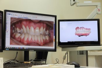 An orthodontists visuals of a patient's teeth and a digital model