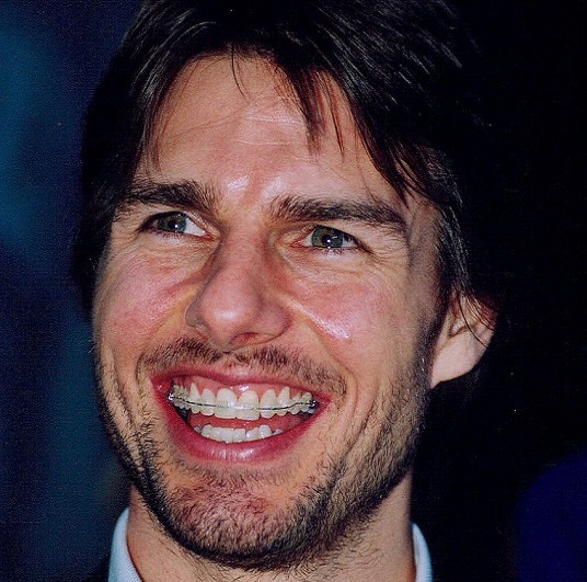 tom cruise teeth photos