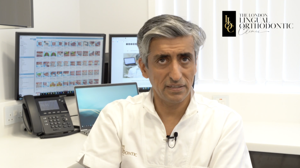 Teeth whitening with lingual braces The London Lingual Orthodontic Clinic